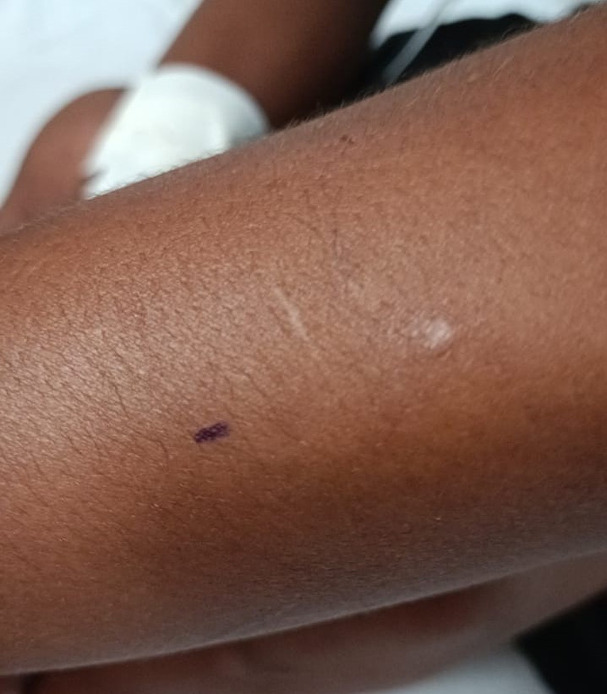 Enquanto soltava pipa, adolescente de 13 anos é picado por cobra em praça pública com mato alto em Presidente Prudente
