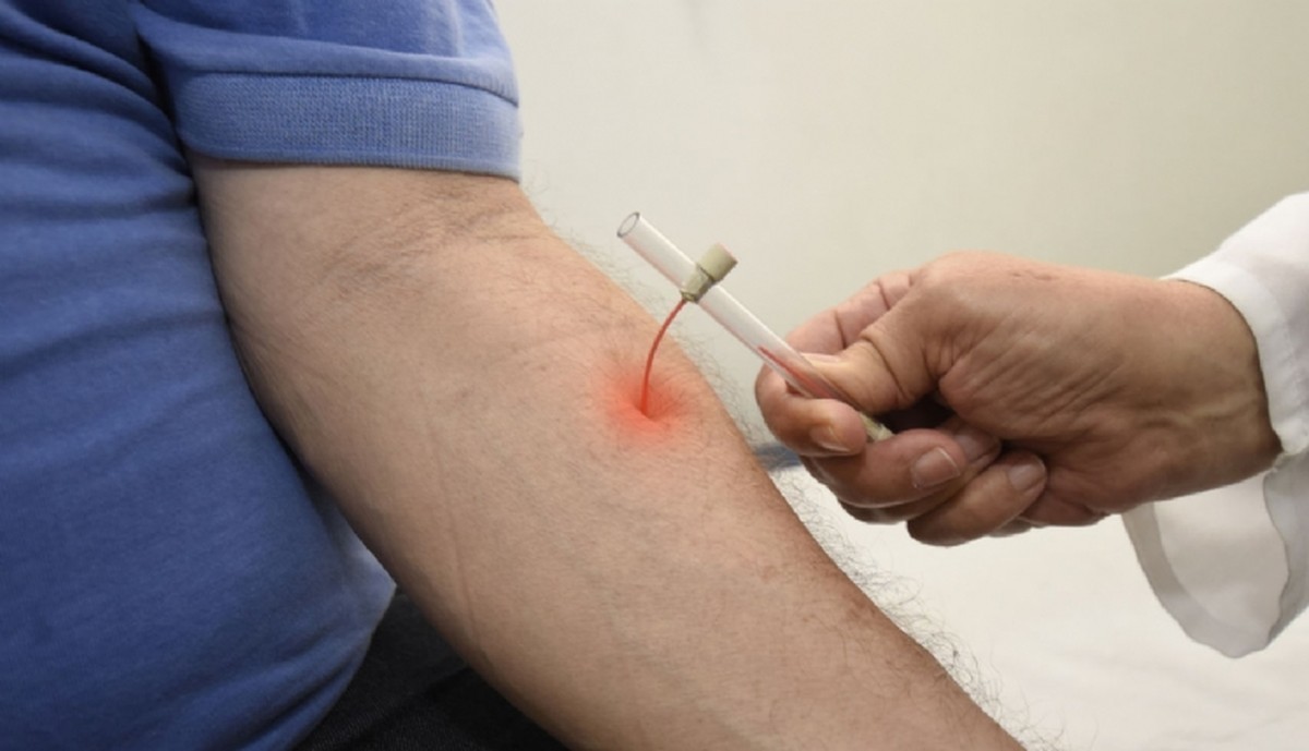 Janeiro Roxo: Vigilância Epidemiológica intensifica trabalhos de diagnóstico e combate à hanseníase em Presidente Prudente