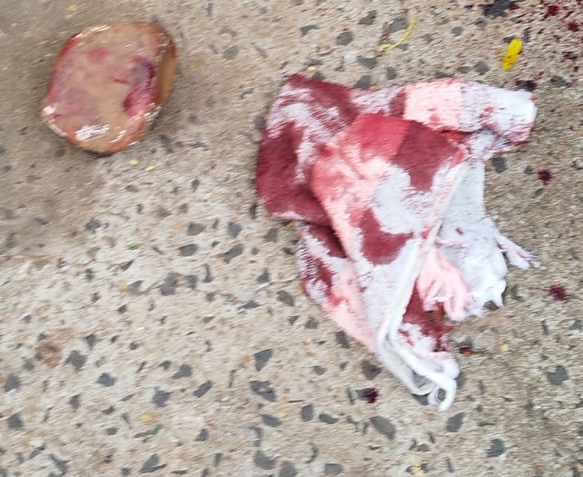 Justiça decreta prisão preventiva de morador de rua que acertou pedradas na cabeça de outro homem em briga por cachaça