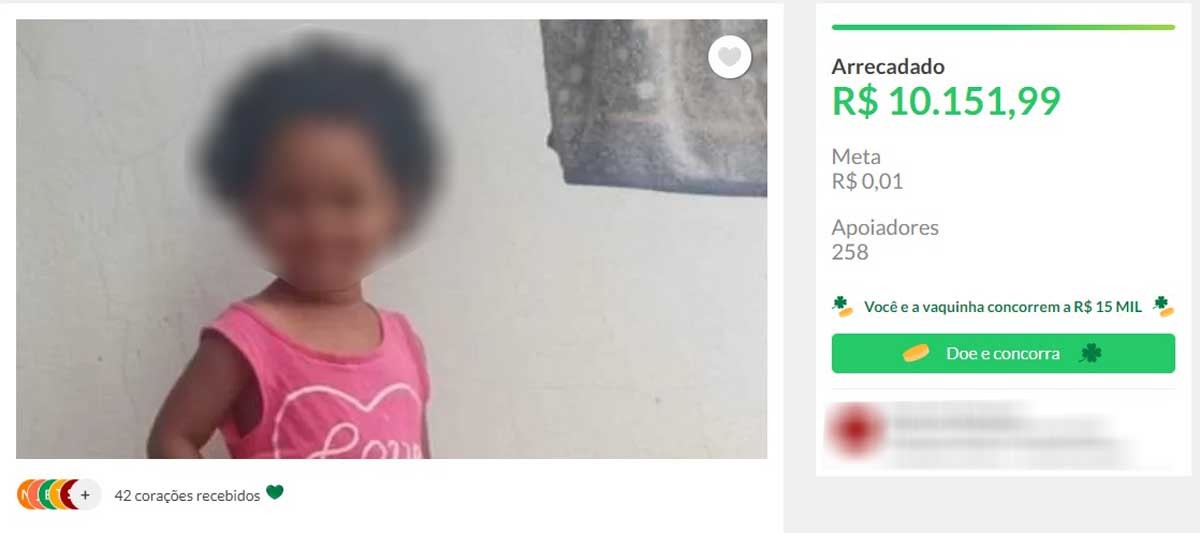 Menina que teve perna amputada após atropelamento apresenta melhora na saúde e recebe mais de R$ 10 mil em ‘vaquinha’ para custear tratamento
