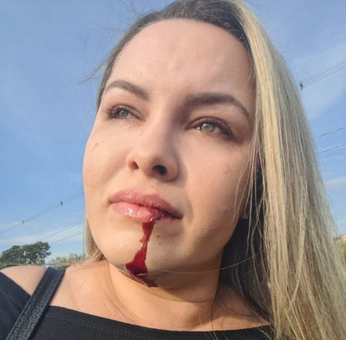 Motociclista sofre corte na boca provocado por linha chilena de pipa; ‘se estivesse em alta velocidade, eu morreria’, diz vítima | Presidente Prudente e Região