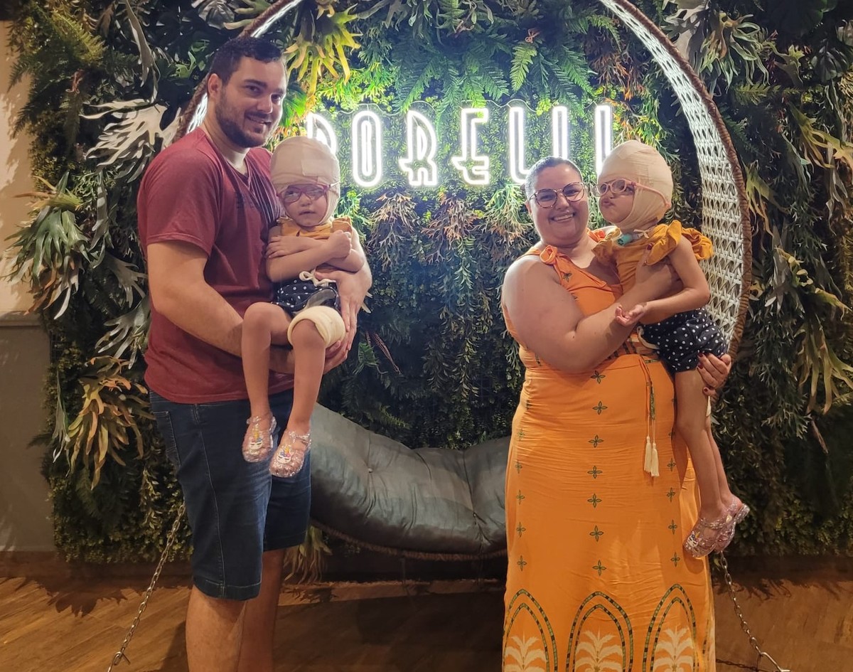 Após três anos de luta, gêmeas siamesas separadas em cirurgia de 25h voltam com família para casa, em Piquerobi: 'Muita gratidão'