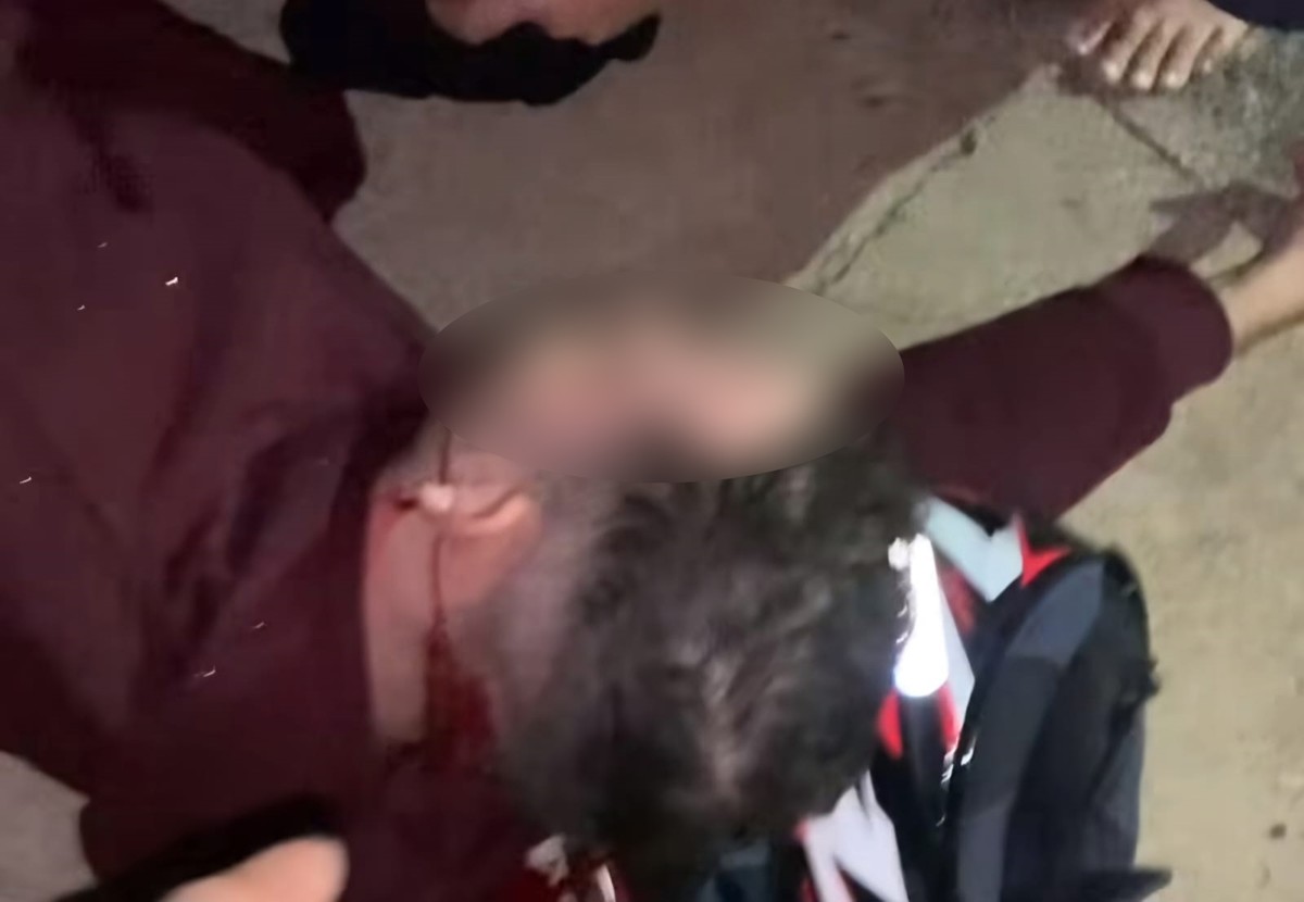 Policial militar acerta tiro na nuca de motociclista que tentou escapar de abordagem em Presidente Prudente